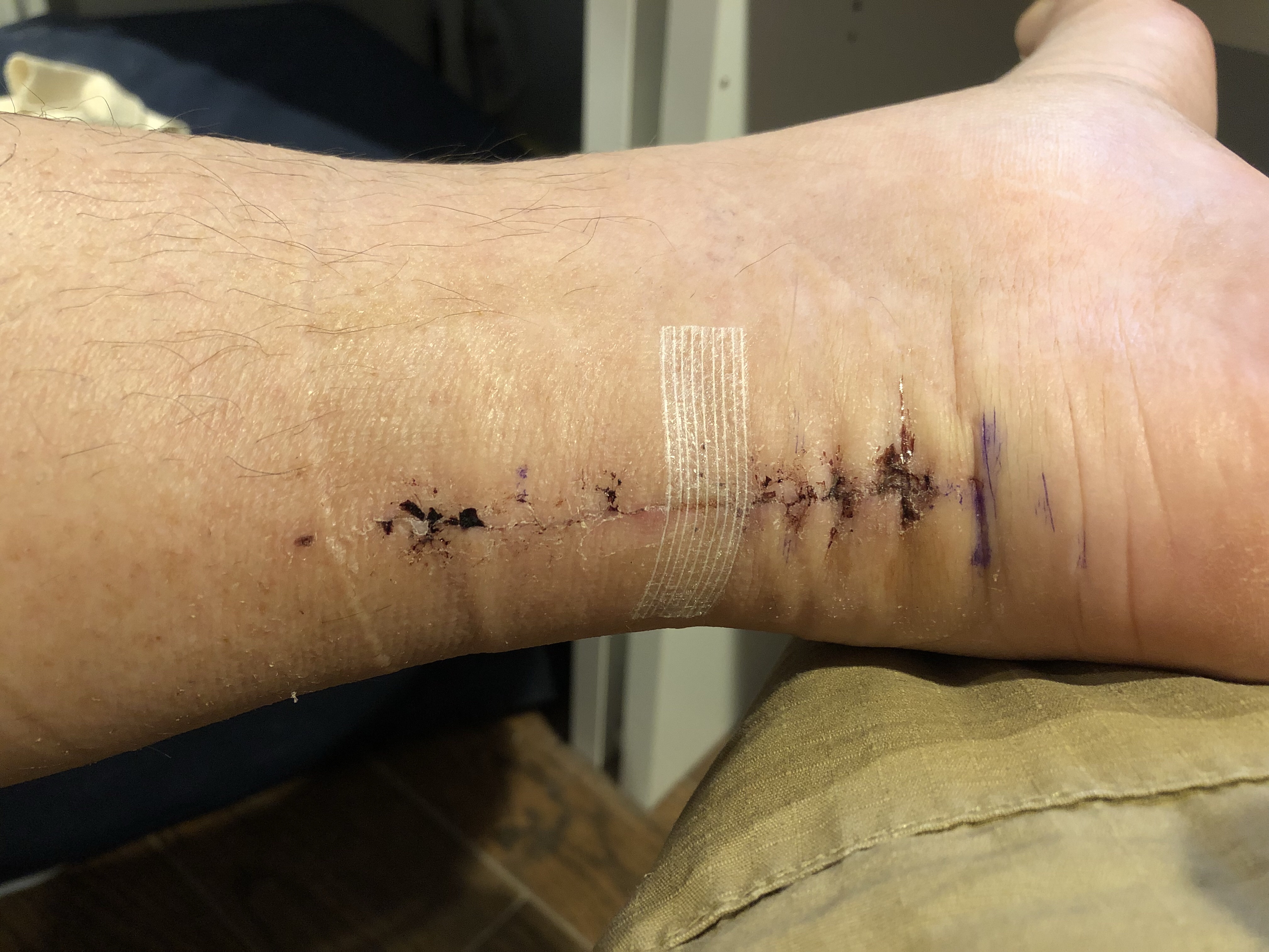 Right after I got back from the doctor on August 10th.